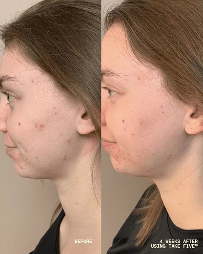 Three Ships |  Take Five - Hypochlorous Acid Balancing Face + Body Spray